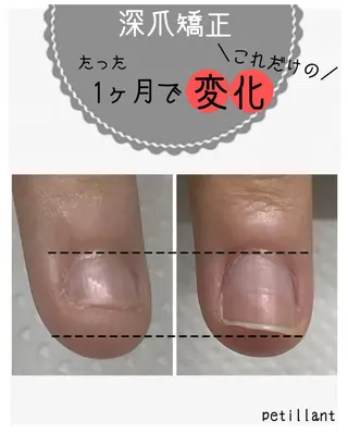 ネイル nail salon petillantのネイルデザイン
