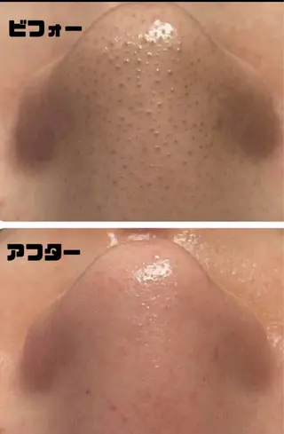 山崎 陽子のエステ・リラクイメージ