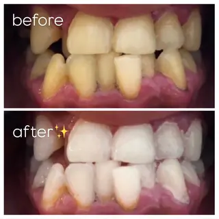 エクシア津駅前店所属・セルフホワイトニング エクシア津駅前店のその他イメージ