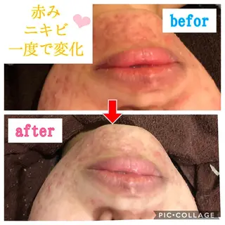 セミロング カラー パーマ ヘアアレンジ メンズ キッズ ネイル マツエク・マツパ 金の糸脱毛 産毛ケア専門のエステ・リラクイメージ