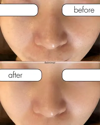 南森町・肌質改善 BELMIMARのエステ・リラクイメージ