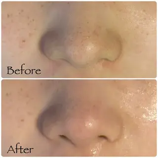 ソワン所属・脱毛 フェイシャル soin~ソワン~のエステ・リラクイメージ