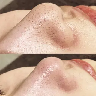 サロンドゥ ルシエルのエステ・リラクイメージ