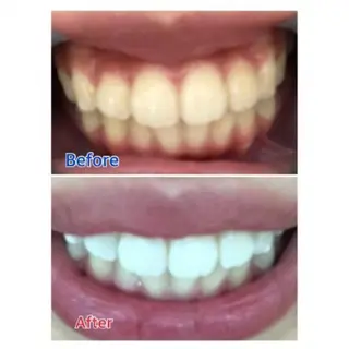 Ｍ渋谷 ホワイトニングのエステ・リラクイメージ