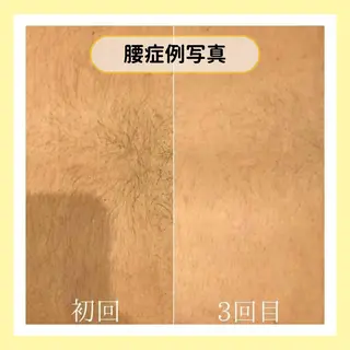 金山/脱毛/美肌 ULULUのエステ・リラクイメージ