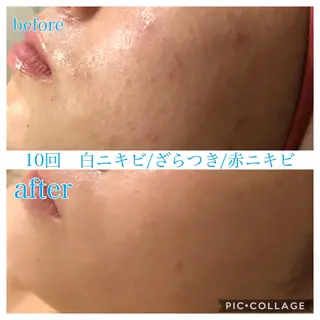 セミロング カラー パーマ ヘアアレンジ キッズ ネイル マツエク・マツパ EnsorClair 代表 野口真央のエステ・リラクイメージ