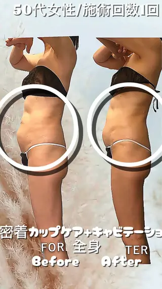 痩身・脱毛・肌管理 Rechica心斎橋のエステ・リラクイメージ