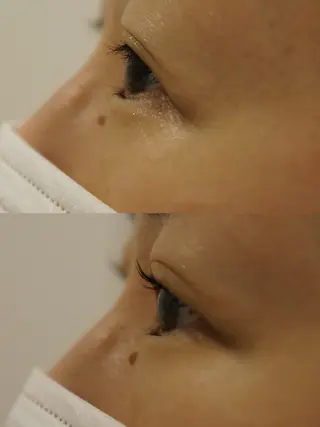 マツエク・マツパ 中村 GLOWのマツエク・マツパデザイン