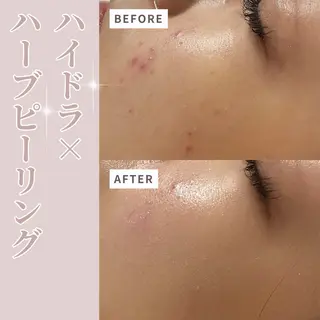 プライベートサロン Belle（ベル）のエステ・リラクイメージ