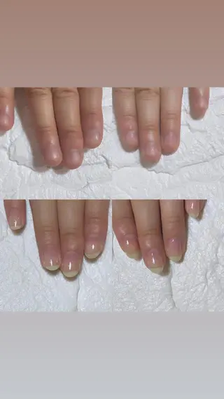 ネイル 自爪育成・巻き爪 補正講師　津蔵のネイルデザイン