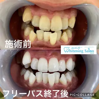 アイラッシュ ホワイトニング四日市のマツエク・マツパデザイン