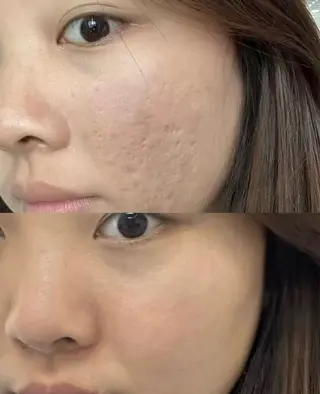 マツエク・マツパ aliaハーブ水光店 エステティシャン募集のエステ・リラクイメージ