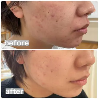 beauty salon  SUKOBI所属・ﾋﾞｭｰﾃｨｻﾛﾝ SUKOBIのエステ・リラクイメージ