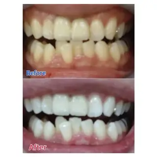 M渋谷 ホワイトニングのエステ・リラクイメージ