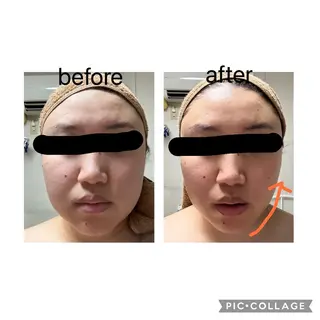 エステティックサロン YouMeのエステ・リラクイメージ