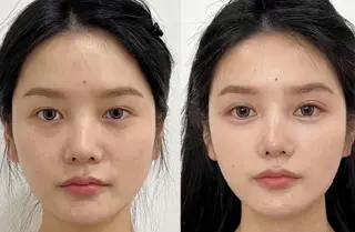 マツエク・マツパ 愛維美水光美肌専門店 メンズレディースokのエステ・リラクイメージ