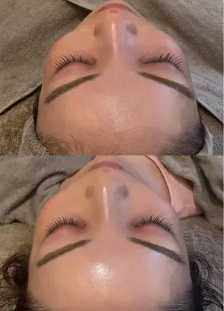 美容鍼灸サロン mahoroba院長のエステ・リラクイメージ