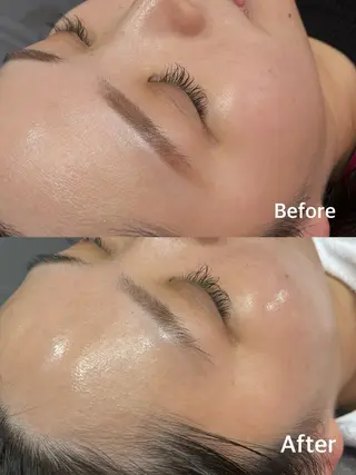 小顔専門看護師クリニカルサロンCOCO所属・小顔と美肌サロン クリニカルサロンココのエステ・リラクイメージ