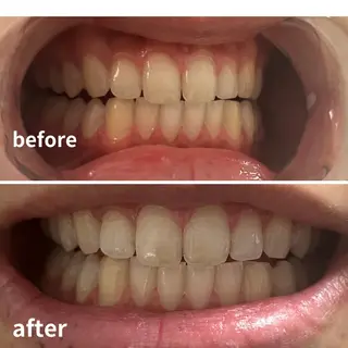 メンズ エマニエル USAのエステ・リラクイメージ