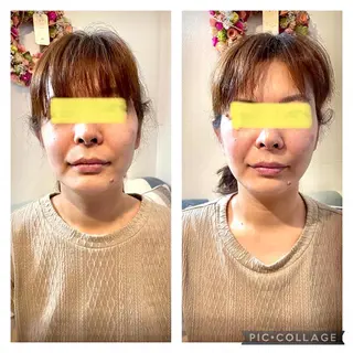 芝田 ミチコのエステ・リラクイメージ