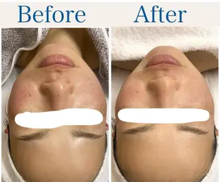 ビューティーサロン　プリズム所属・久留本 茜のエステ・リラクイメージ