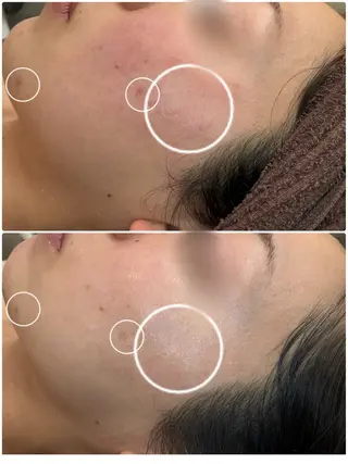 ＋belle／深澤 真緒🩵のエステ・リラクイメージ