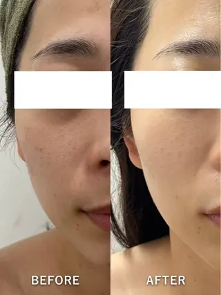 韓国美肌/肌質改善 【天神】のエステ・リラクイメージ