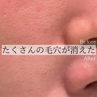Ginza Charerのエステ・リラクイメージ
