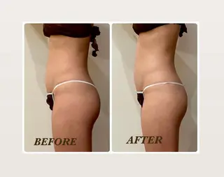 Prima 痩身脱毛 にごうかおりのエステ・リラクイメージ