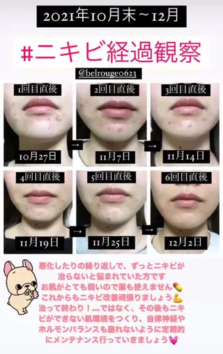 自由が丘📍 Belrougeのエステ・リラクイメージ