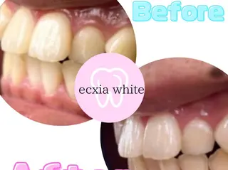 セルフホワイトニング エクシア浜松店のその他イメージ