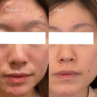 韓国肌管理・肌質改善 EARNEST心斎橋のエステ・リラクイメージ