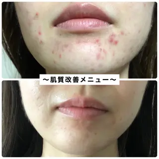 自由が丘📍 Belrougeのエステ・リラクイメージ