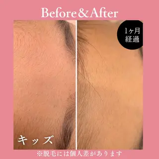 メンズ キッズ 有人型セルフサロン 脱毛/痩身/美顔のエステ・リラクイメージ