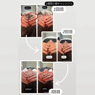 小顔矯正 MEGUMIのエステ・リラクイメージ