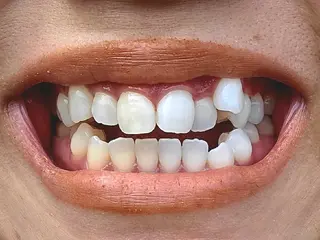 歯科提携セルフダック 宇都宮駒生店のエステ・リラクイメージ