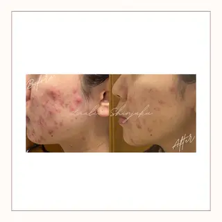 美腸サロン🌺 腸もみ/小顔/リンパのエステ・リラクイメージ