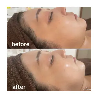 アロマ•ピーリング SalonYokoのその他イメージ