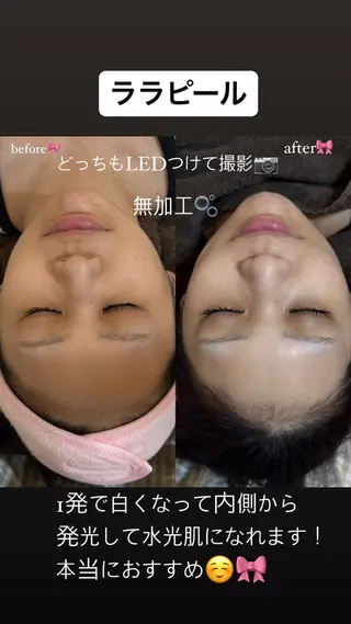 エクパ韓国束感まつげ 🎀耳つぼジュエリーのその他イメージ