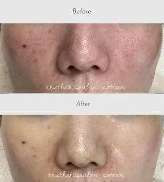 都度払い 肌質改善専門サロンのエステ・リラクイメージ