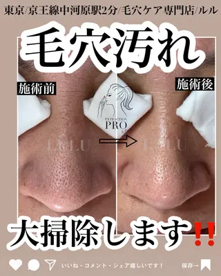 LULU ルルのエステ・リラクイメージ