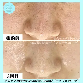 毛穴ケア専門サロン アメリオボーテのその他イメージ