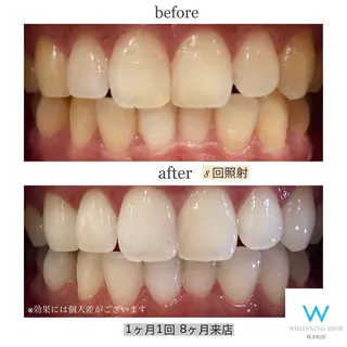 ホワイトニングショップ桜木町店所属・ホワイトニング ショップ桜木町店のその他イメージ