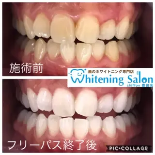 歯科レベルの白さ💎 ✨ホワイトニング豊田のエステ・リラクイメージ