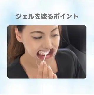 ホワイトニング ショップ伊丹店のその他イメージ