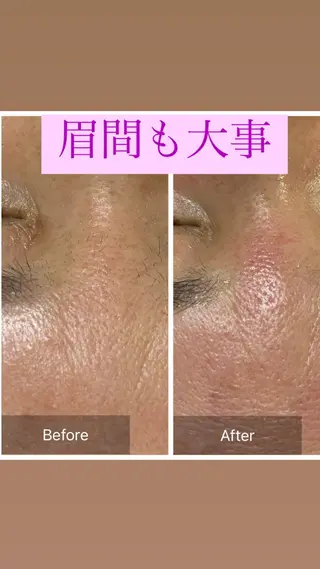 産毛専門店 Bittoのエステ・リラクイメージ