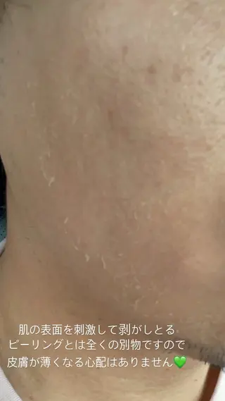 brilliance所属・老化肌トラブル肌専門 Brillianceのエステ・リラクイメージ