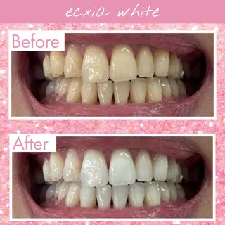 セルフホワイトニング エクシア泉中央店のその他イメージ