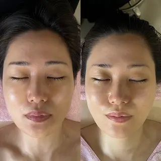 salondeBe 🩵フェイシャル専門のエステ・リラクイメージ