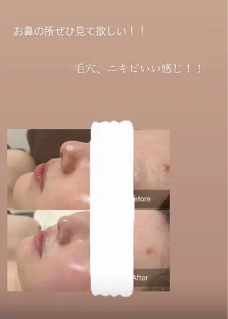 天使の艶肌　REVIハーブピーリング＆ヘッドスパ 武蔵小杉店所属・天使の 艶肌のエステ・リラクイメージ